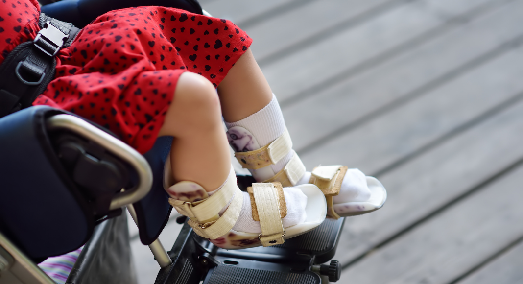 Guide to Albuquerque Area Resources for Kids with Differences & Disabilities