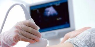Where to Have an Ultrasound in Albuquerque