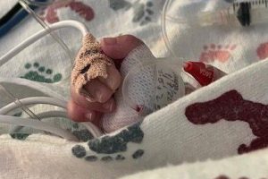 Congenital Heart Defect ::  My Daughter Kendall’s Story