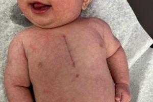 Congenital Heart Defect ::  My Daughter Kendall’s Story